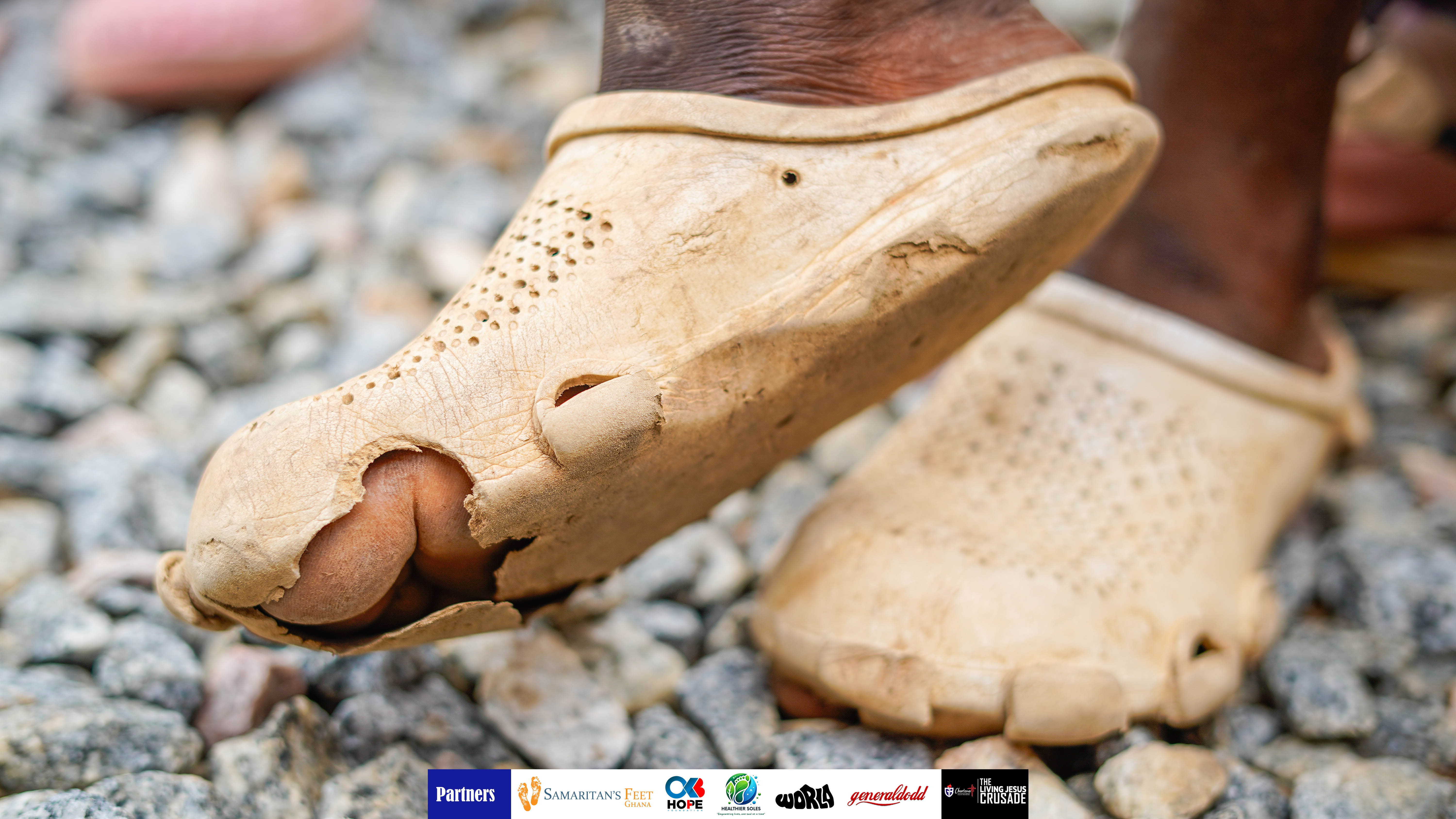Podoconiosis disease awareness